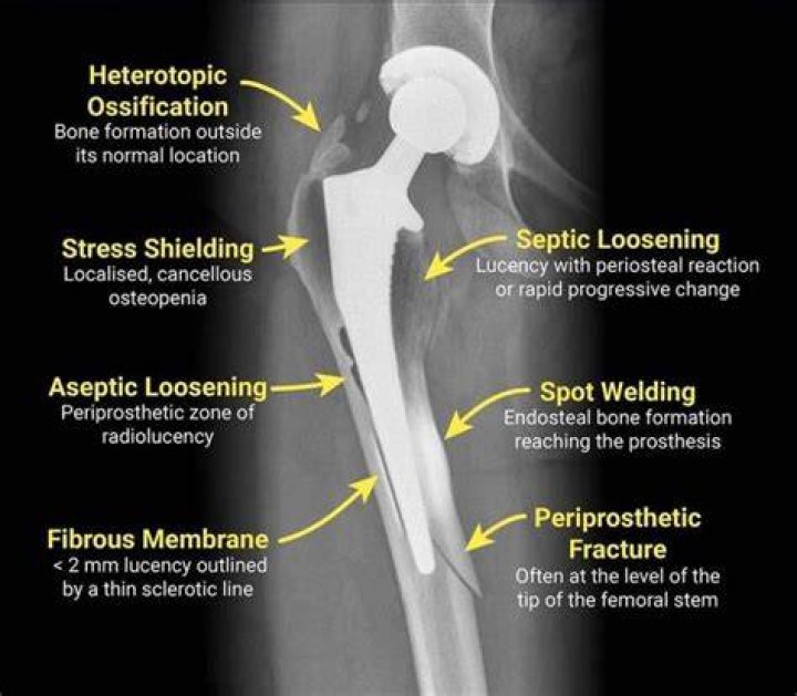 What does the word postsurgical mean?