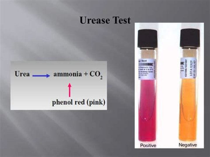What does urease positive mean?