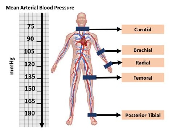 What increases arterial blood pressure?
