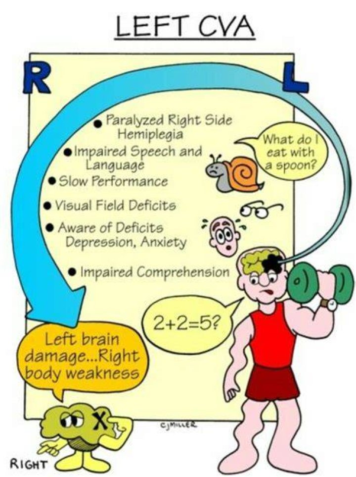 What is a left cva?