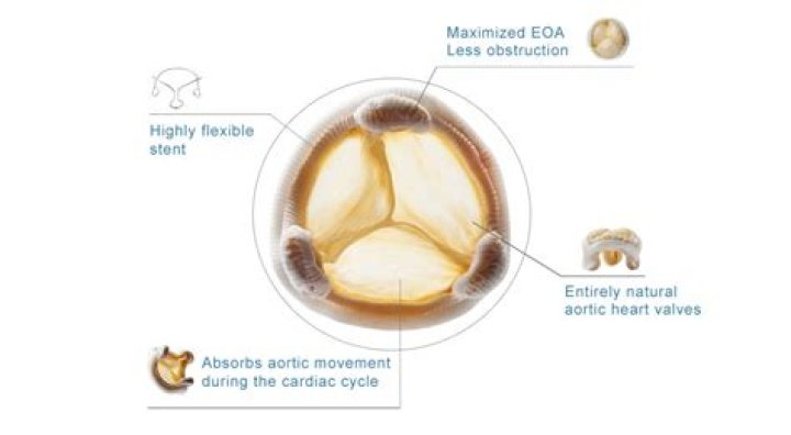 What is a porcine valve?