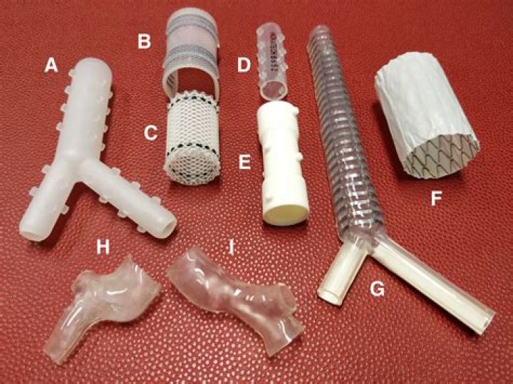 What is airway stenting?