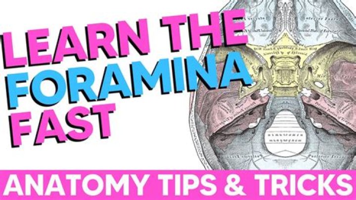 What is atraumatic head?