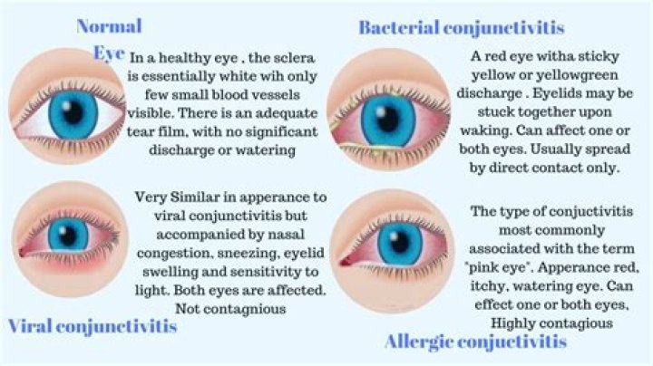 What is eye carnosity?