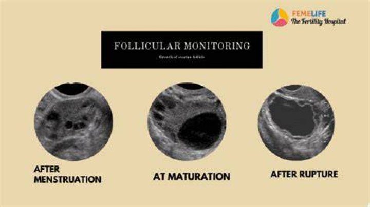 What is follicular tracking?