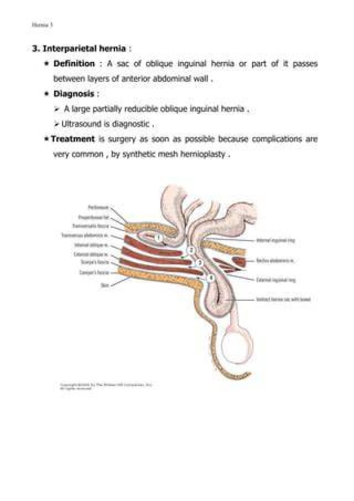 What is interparietal hernia?