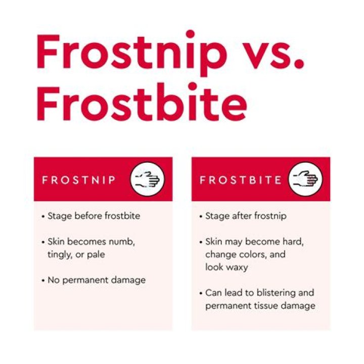 What is the difference between frostnip?