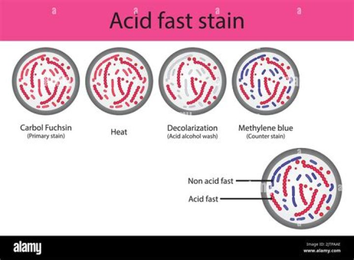 What is the stain for acid fast stain?