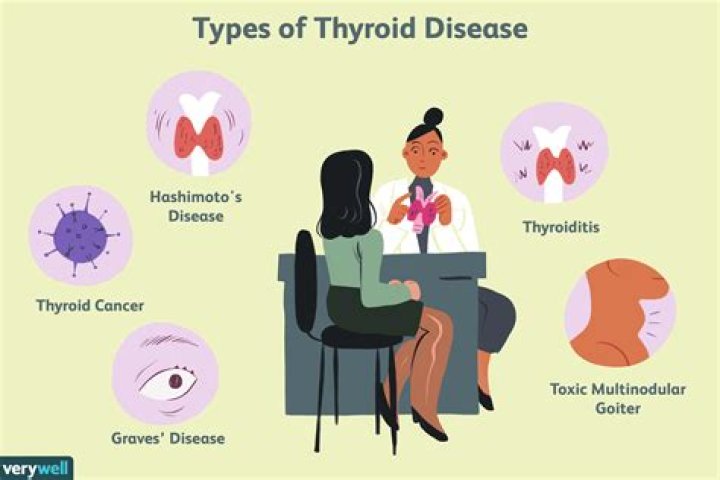 What is thyroid syndrome?