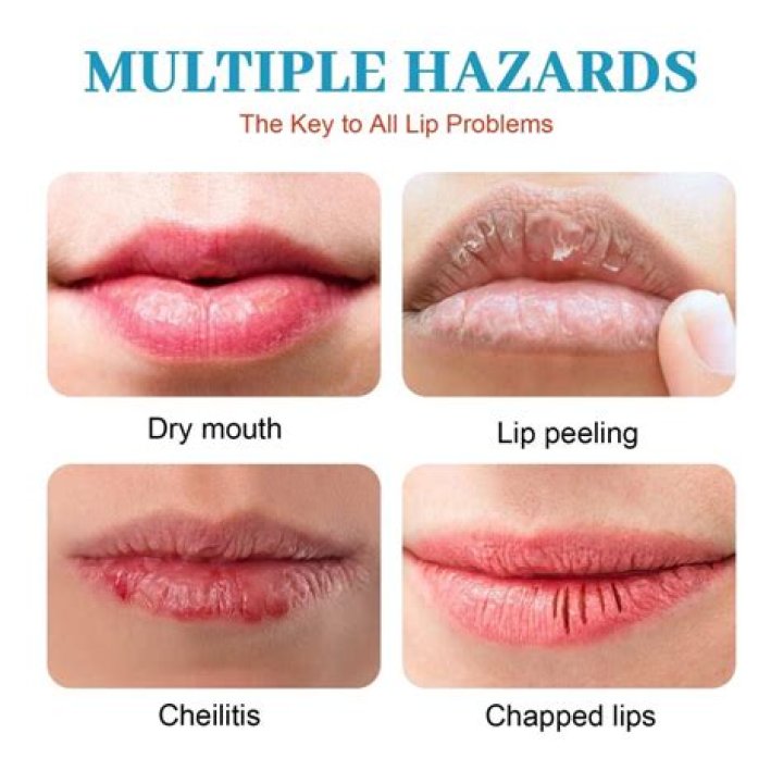What makes your lips unchapped?