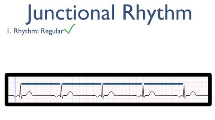 What rhythm originates from the ventricle?