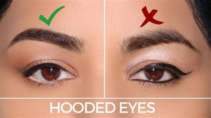 Whats a hooded eyelid?