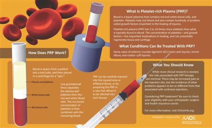 Whats a prp shot?