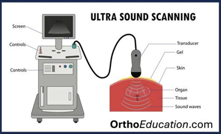 Whats an ultrasound scan?