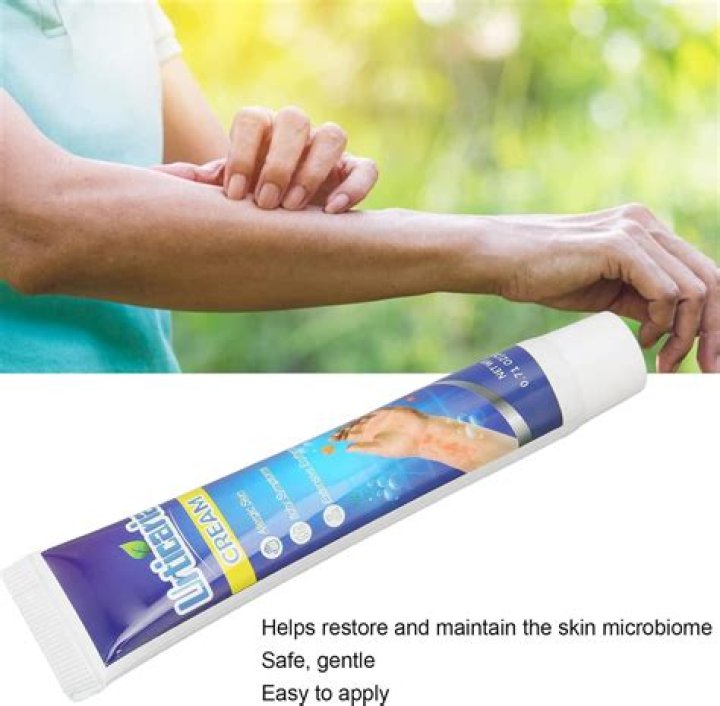 Whats good for itching skin?