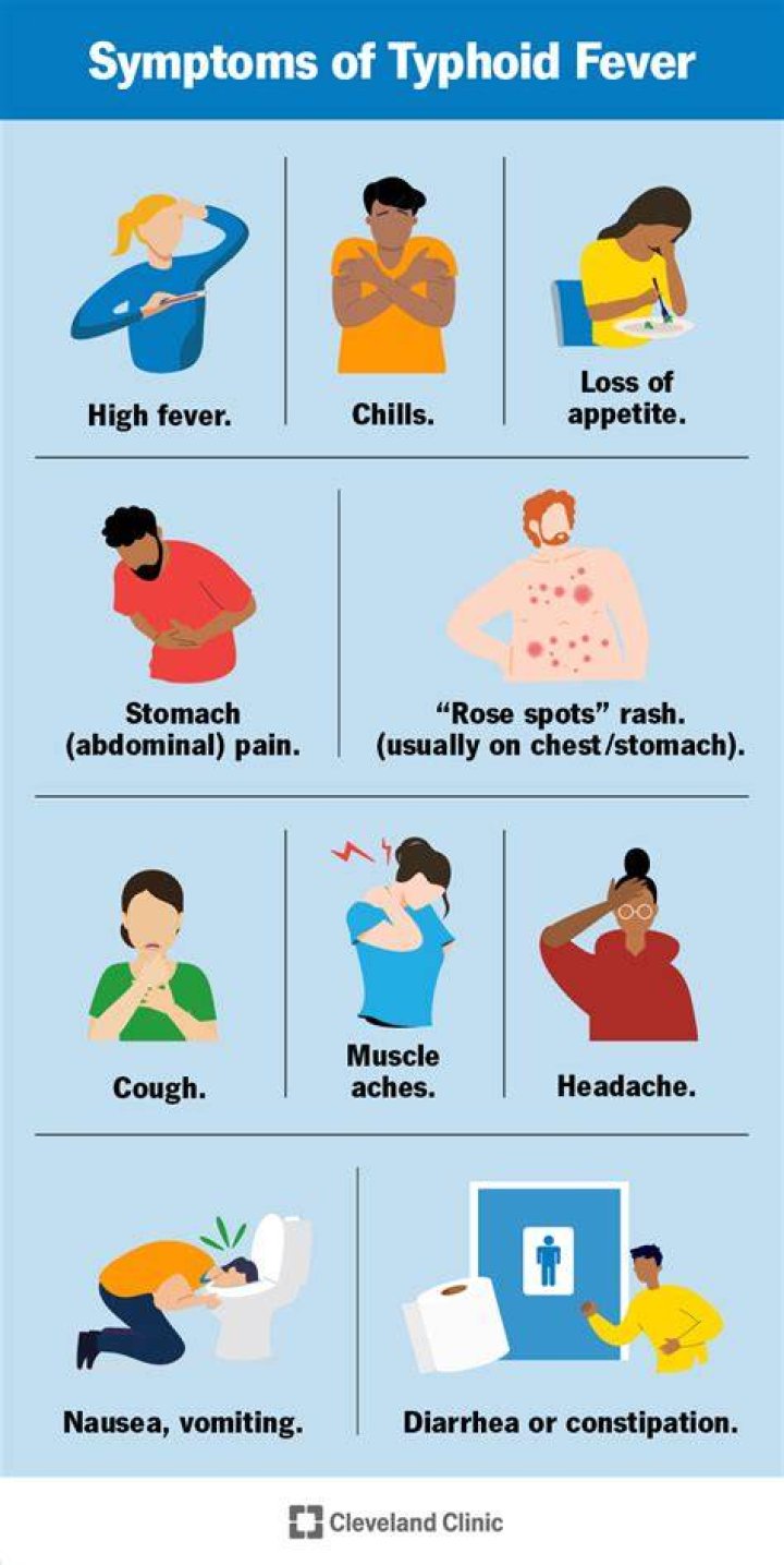 When did typhus fever start?