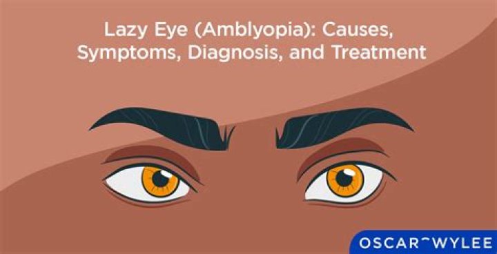 When does amblyopia start?