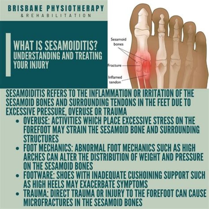 When does sesamoiditis go away?