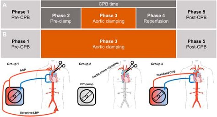 When is cardioplegia used?