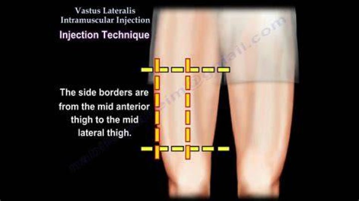 When to use vastus lateralis injection site?