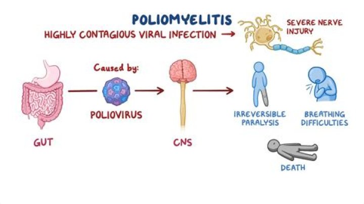 Where did poliovirus come from?