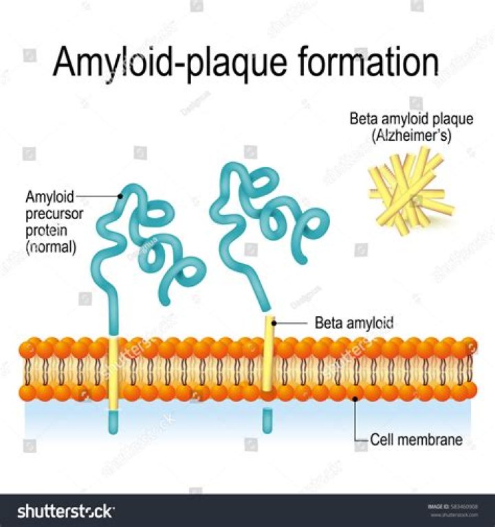 Where do amyloid plaques accumulate?