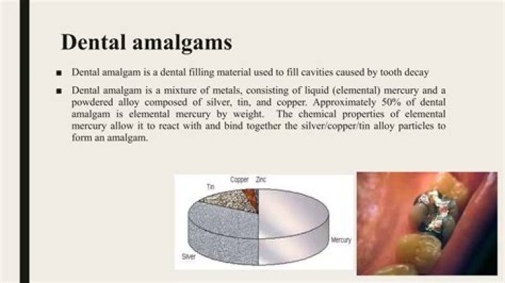 Where is amalgam used?