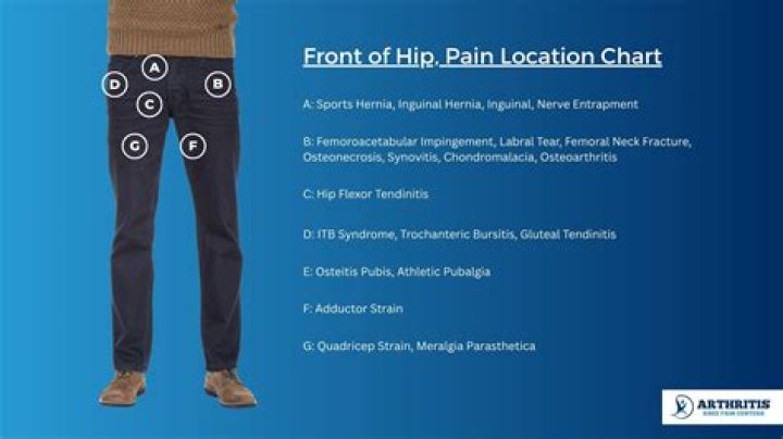 Where is arthritic hip pain?