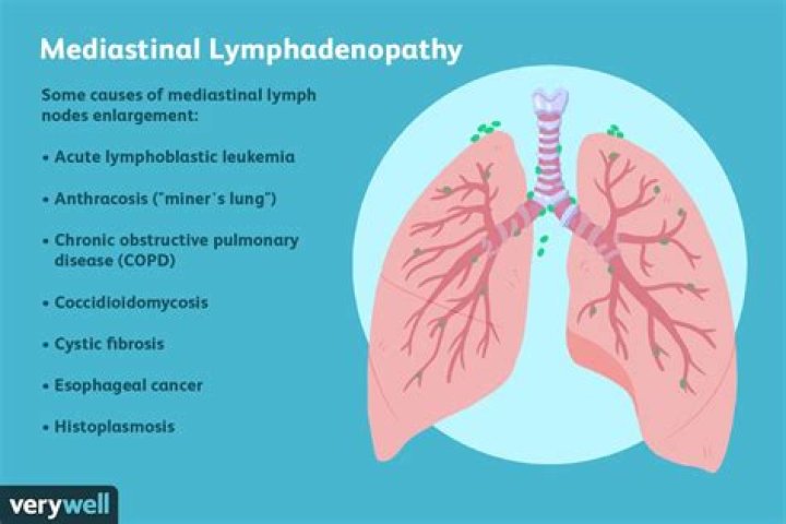 Where is mediastinal lymphadenopathy?