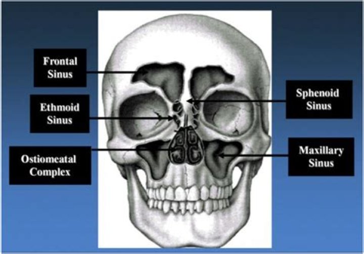 Where is the frontoethmoidal suture located?