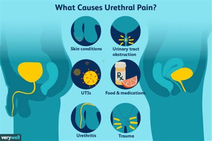 Where is urethra pain?