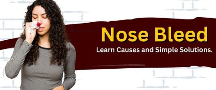 Where to squeeze nose bleed?