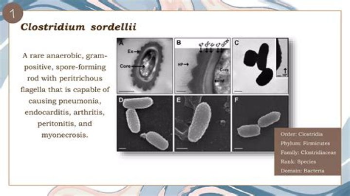 Which of the following is characteristic of clostridia?