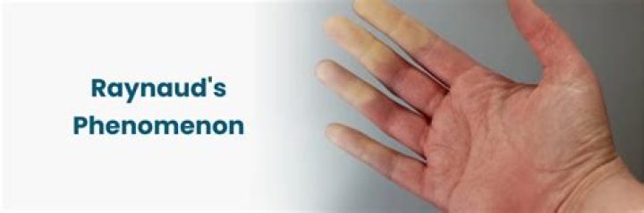 Which pathogenesis is primarily responsible for raynaud phenomenon?