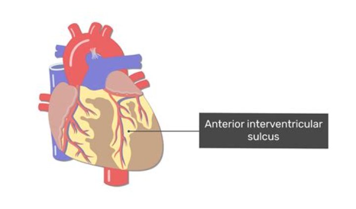Which sulcus overlies the interventricular septum?