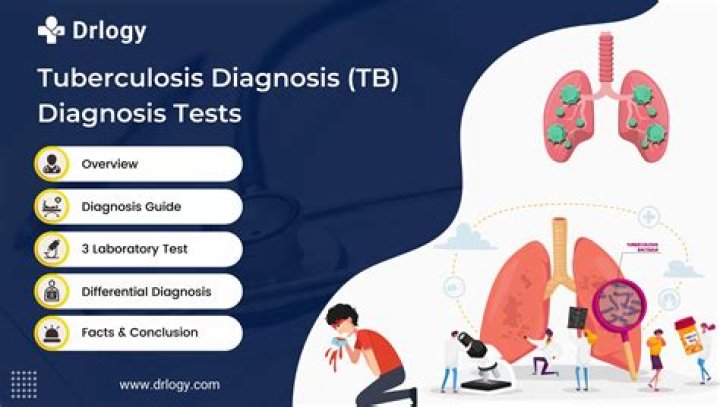 Which test is used to screen for tuberculosis?