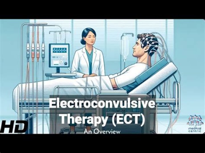 Who does electroconvulsive therapy?