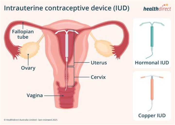 Who intrauterine contraceptive device?