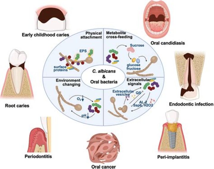 Who is candida louis?