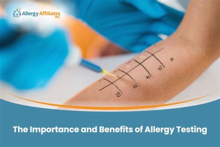 Who test for allergies?