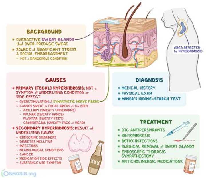 Who treats craniofacial hyperhidrosis?