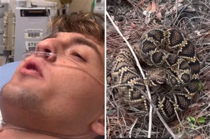 Who was bitten by a severed snake head?