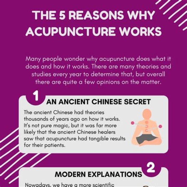 Why acupuncture is not science?