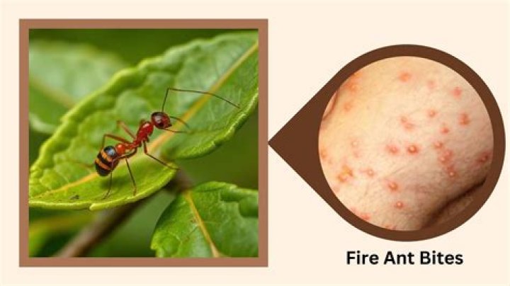 Why ants bite human?