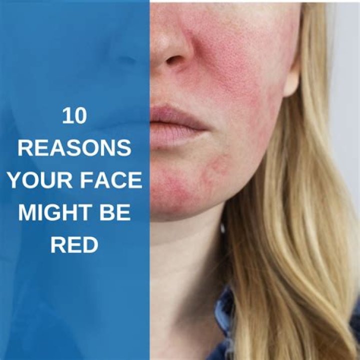 Why cheeks become red?