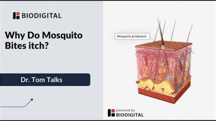 Why do insect bites itch?