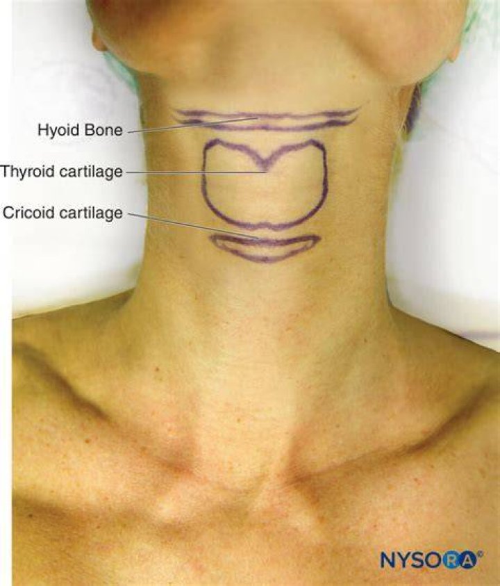 Why does my cricoid cartilage hurt?