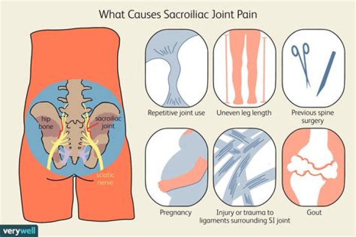Why does my sacrum hurt?