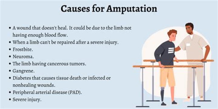 Why is amputation necessary?
