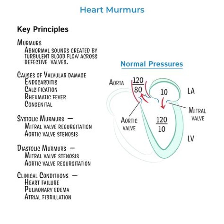 Why mid diastolic murmur in mitral stenosis?